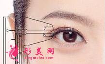 雙眼皮手術(shù)過程痛苦嗎