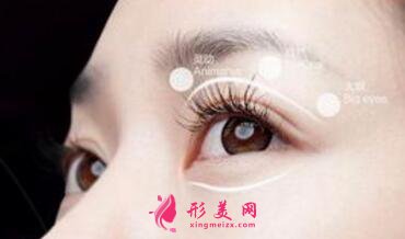 雙眼皮手術(shù)過程痛苦嗎