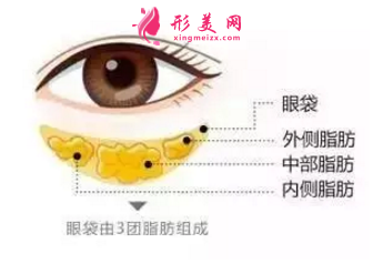 祛眼袋手術(shù)要忌口多久