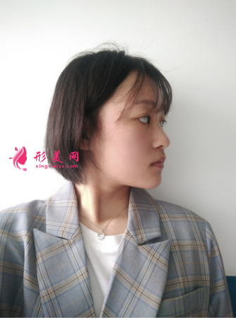 成都美萊做雙眼皮多少錢(qián)_埋線(xiàn)雙眼皮+外開(kāi)眼角怎么樣_案例效果
