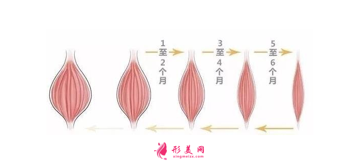 打瘦臉針大概多少錢？瘦臉的原理是什么？