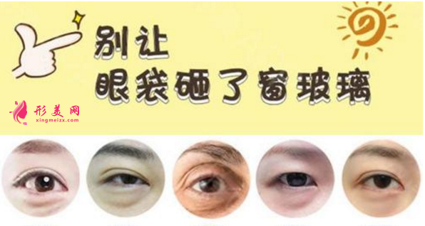 做去眼袋手術(shù)多少錢？有哪些方法？