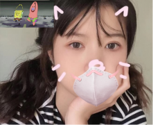 北京克萊美舍整形醫(yī)院張冰潔做的全切雙眼皮半年的變化。
