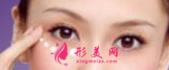 手術(shù)切除眼袋后疼不疼？