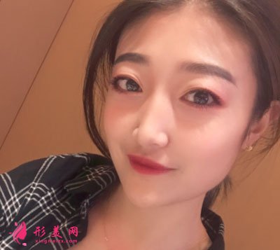 北京畫美瘦臉案例