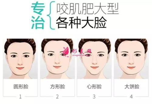 打瘦臉針效果怎么樣