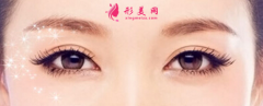 鄭州整形醫(yī)院埋線雙眼皮多少錢？