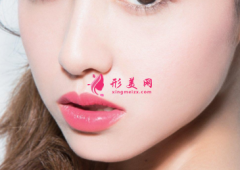 自體脂肪填充臉部恢復(fù)時(shí)間長嗎？