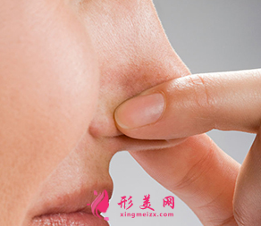 鼻翼縮小整形術(shù)多久恢復(fù)自然