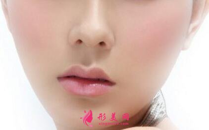 鼻翼縮小整形術(shù)多久恢復(fù)自然