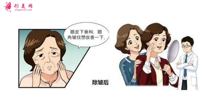 注射除皺效果怎么樣？附術(shù)前術(shù)后注意事項(xiàng)！