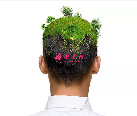 頭發(fā)種植效果可靠嗎？術前注意事項大全！