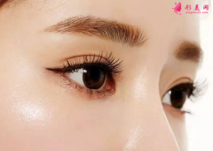 雙眼皮手術(shù)的價格跟什么因素有關(guān)