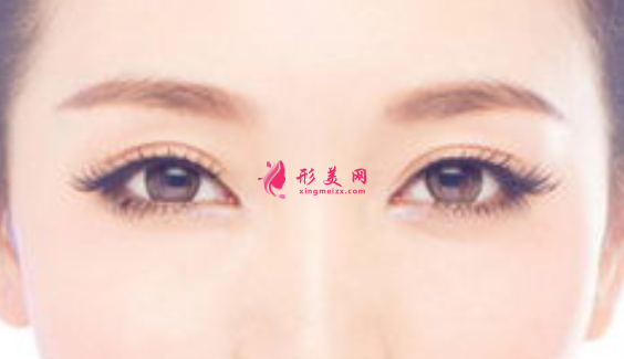 切開雙眼皮的手術(shù)過程是什么樣的