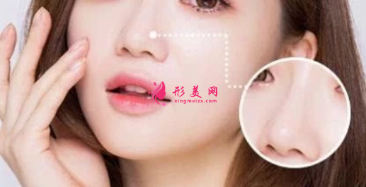 鼻翼寬大要怎么辦好