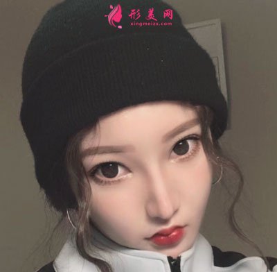 深圳顏美醫(yī)療美容門診部吸脂案例