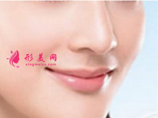 廣州假體隆鼻價(jià)格受什么因素影響