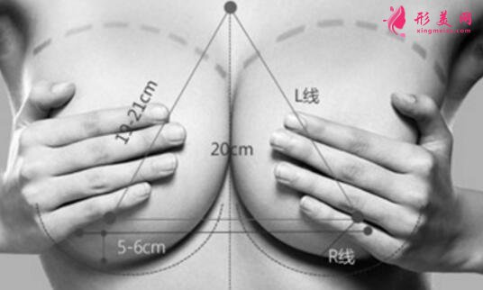 復(fù)合豐胸怎么樣