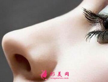 自體軟骨隆鼻后會(huì)鈣化嗎