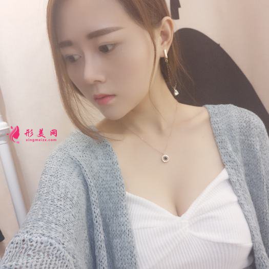 做自體肋軟骨和膨體綜合隆鼻后感受 做自體肋軟骨和膨體綜合隆鼻后感受