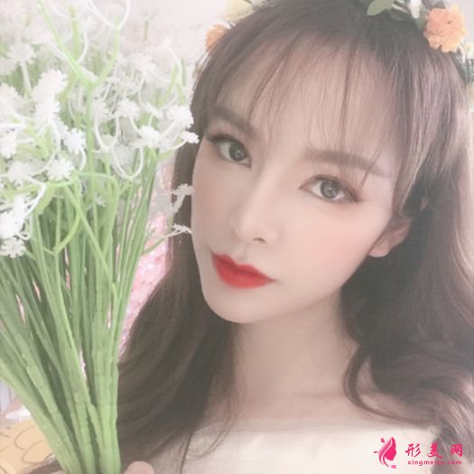 肋軟骨鼻綜合之后自拍美美噠 肋軟骨鼻綜合之后自拍美美噠