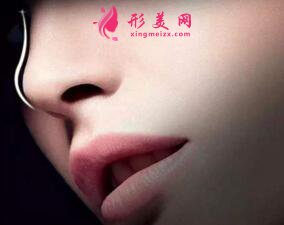自體軟骨隆鼻的費(fèi)用是多少
