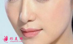 鄭州整形醫(yī)院自體軟骨隆鼻的費(fèi)用是多少?