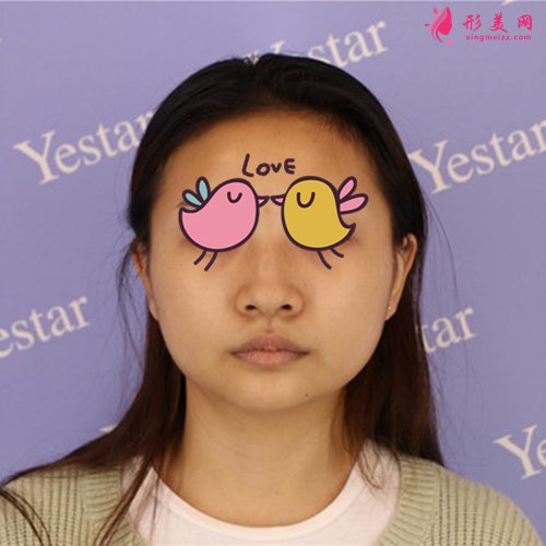 溫州藝星做鼻子怎么樣 溫州藝星做鼻子怎么樣