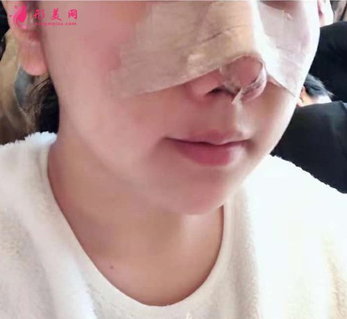 寧波哪個醫(yī)生做鼻子厲害 寧波哪個醫(yī)生做鼻子厲害