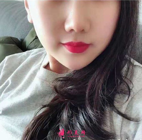寧波壹加壹整形做鼻子好嗎 寧波壹加壹整形做鼻子好嗎