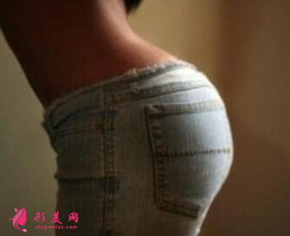 臀部吸脂手術(shù)會(huì)不會(huì)有后遺癥