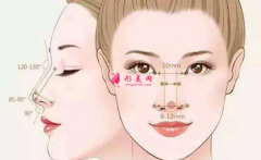 鼻整形失敗修復(fù)的費(fèi)用高嗎？