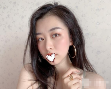 上海九院朱海男微創(chuàng)雙眼皮案例美圖：熟后效果你i嗎？