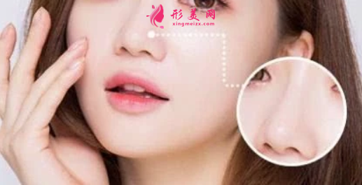 鼻翼縮小手術(shù)會有什么風(fēng)險嗎