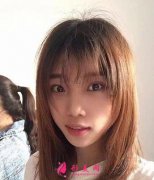 重慶西南醫(yī)院整形科隆鼻案例展示：術(shù)后獲得立體五官！