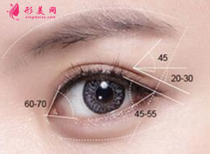 做完開眼角以后還會變小嗎