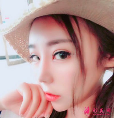 天津圣韓美醫(yī)療美容鼻部多項案例