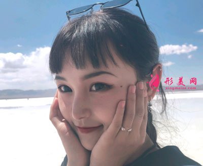 天津維美醫(yī)療美容醫(yī)院鼻部多項案例