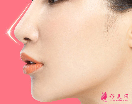 膨體隆鼻會有什么危害嗎