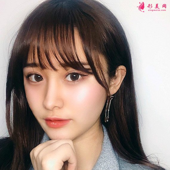 重慶美禪整形醫(yī)院做的全切雙眼皮效果還不錯 重慶美禪整形醫(yī)院做的全切雙眼皮效果還不錯