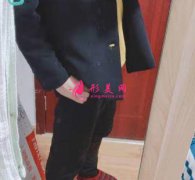 廣州曙光醫(yī)院抽脂怎么樣？90天了，來(lái)聊聊我的恢復(fù)經(jīng)驗(yàn)