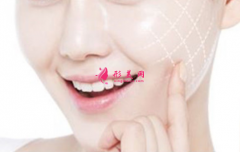 自體脂肪填充臉部的風(fēng)險(xiǎn)大嗎？