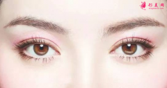 長(zhǎng)沙整形醫(yī)院雙眼皮整形價(jià)格要多少錢