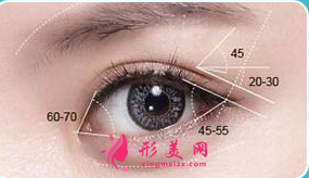 開(kāi)眼角多久可以恢復(fù)好