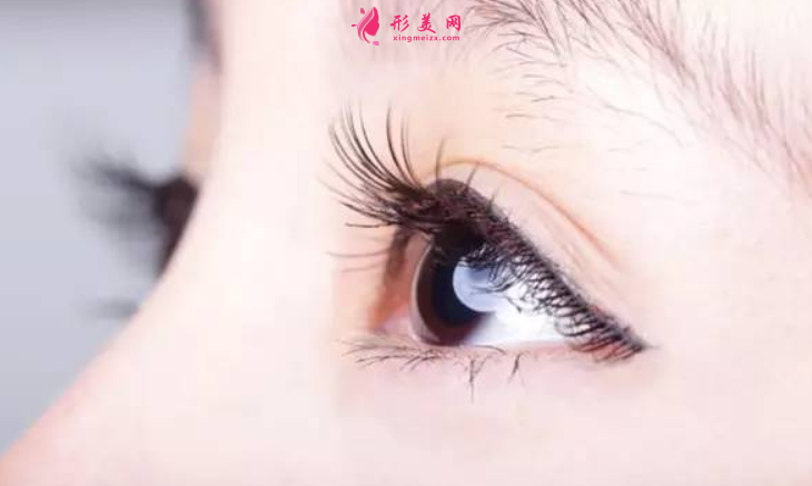 雙眼皮手術(shù)失敗主要原因是什么