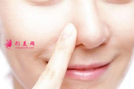 隆鼻假體取出費(fèi)用是多少