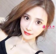 上海首爾麗格下頜角手術(shù)案例，術(shù)后恢復(fù)記錄
