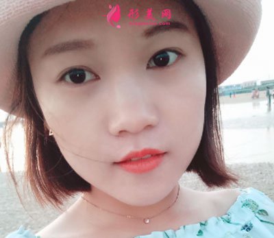 北京歐華醫(yī)療美容水光補水案例