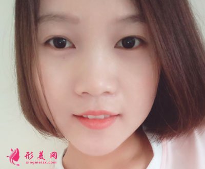北京歐華醫(yī)療美容水光補水案例