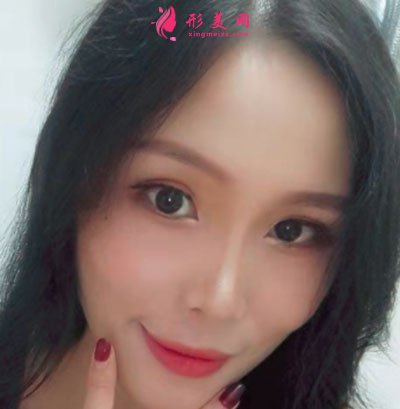 廈門華美醫(yī)療美容門診部除皺瘦臉的案例